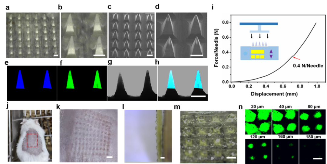 华中科技大学刘奕静、朱锦涛 ACS Nano：ROS响应微针用于银屑病治疗,图片,ROS响应,微针,银屑病,抑制,角质细胞,第2张