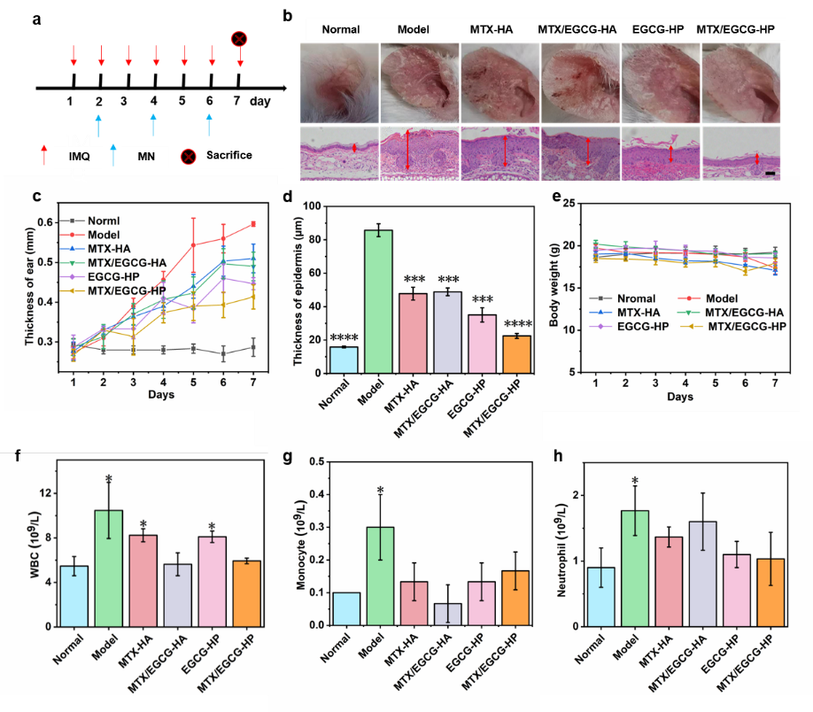 华中科技大学刘奕静、朱锦涛 ACS Nano：ROS响应微针用于银屑病治疗,图片,ROS响应,微针,银屑病,抑制,角质细胞,第4张